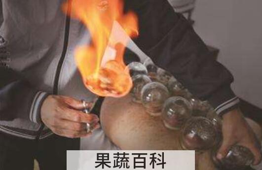 拔火罐的好处和坏处 拔火罐要注意什么
