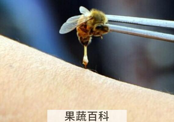 蜜蜂蛰了怎么消肿止痛 蜜蜂蛰消肿的最快方法