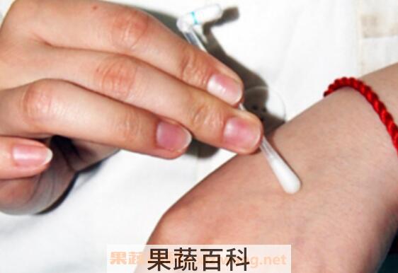 被蜜蜂蛰了怎么消肿快 蜜蜂蛰消肿的最快方法