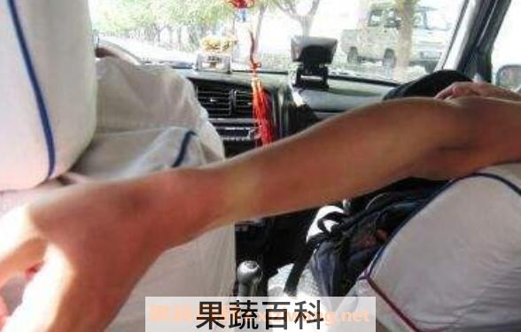 晒伤后怎么处理 晒伤后如何修复