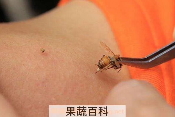 蜜蜂蛰了怎么办 蜂子蜇了最快消肿止痛的方法