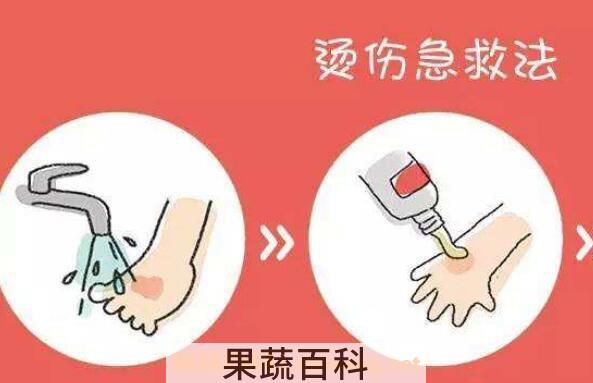烫伤后怎样恢复得快 烫伤疤痕如何消除