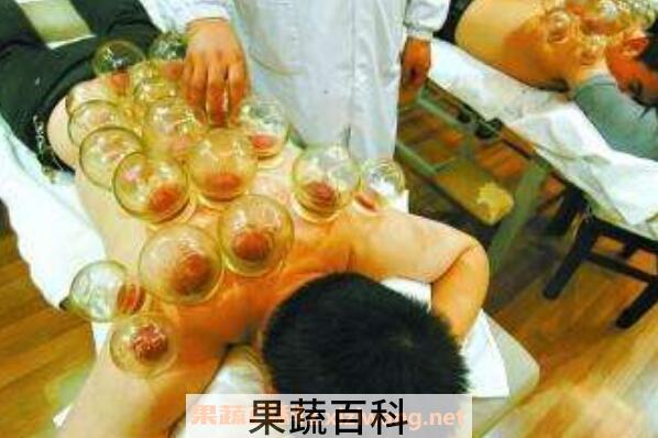 拔火罐有什么好处 拔火罐的好处介绍