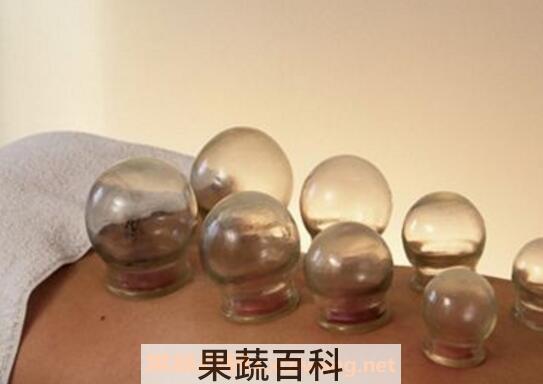 如何拔火罐 什么样的人需要拔血罐