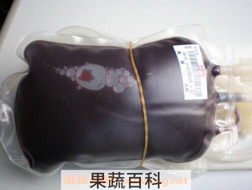 献血要求有哪些 哪些人不能献血