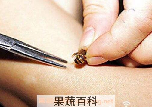 被蜂蜇了怎么办 被蜜蜂蛰了怎么处理