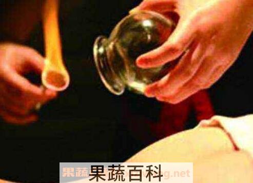 拔火罐的好处和坏处
