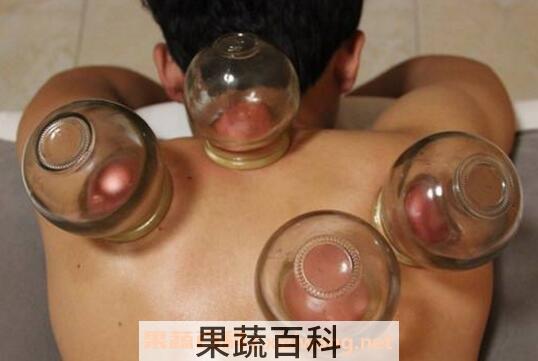 拔罐的好处和坏处