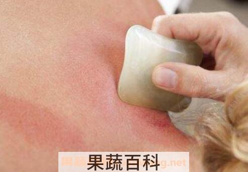 刮痧的好处和坏处